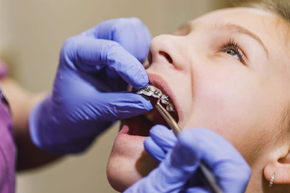 A Dentist can help with odor caused by braces